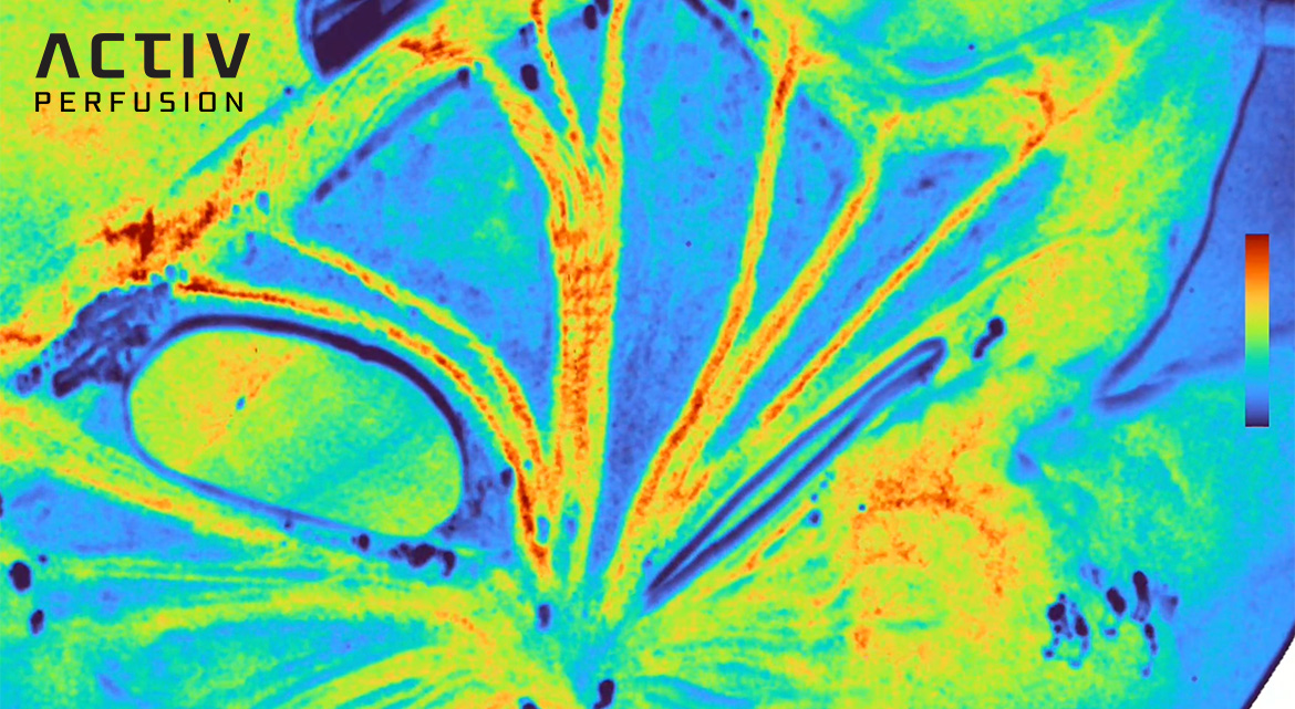 Activ Surgical’s illustration of its ActivPerfusion surgical visualization mode