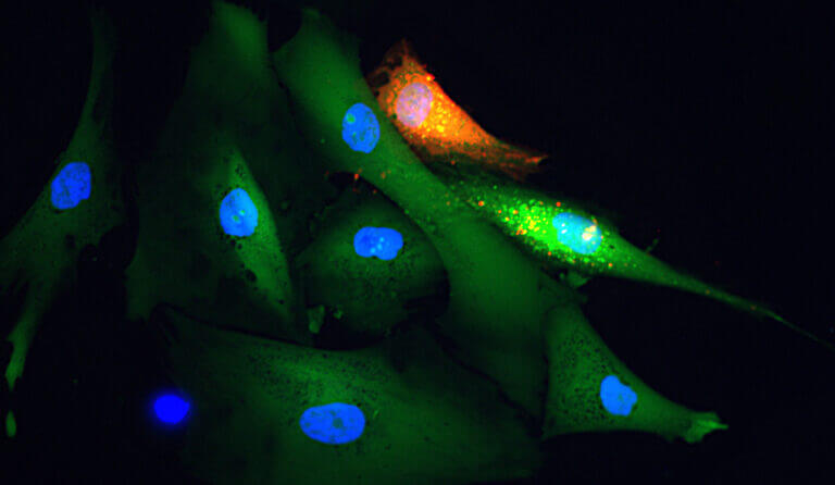 Fluorescence microscopy of a field of cells with blue nuclei and green cytoplasm