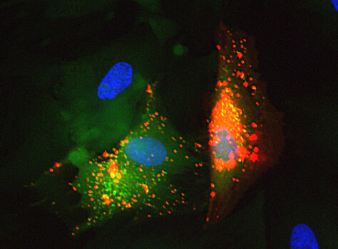 Fluorescence microscopy showing multiple cells with green cytoplasm and orange vesicle uptake