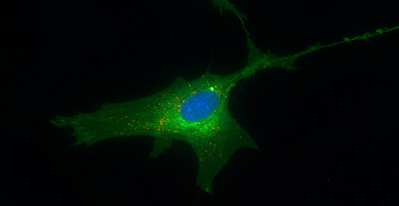 Fluorescence microscopy of a single cell taking up labeled extracellular vesicles