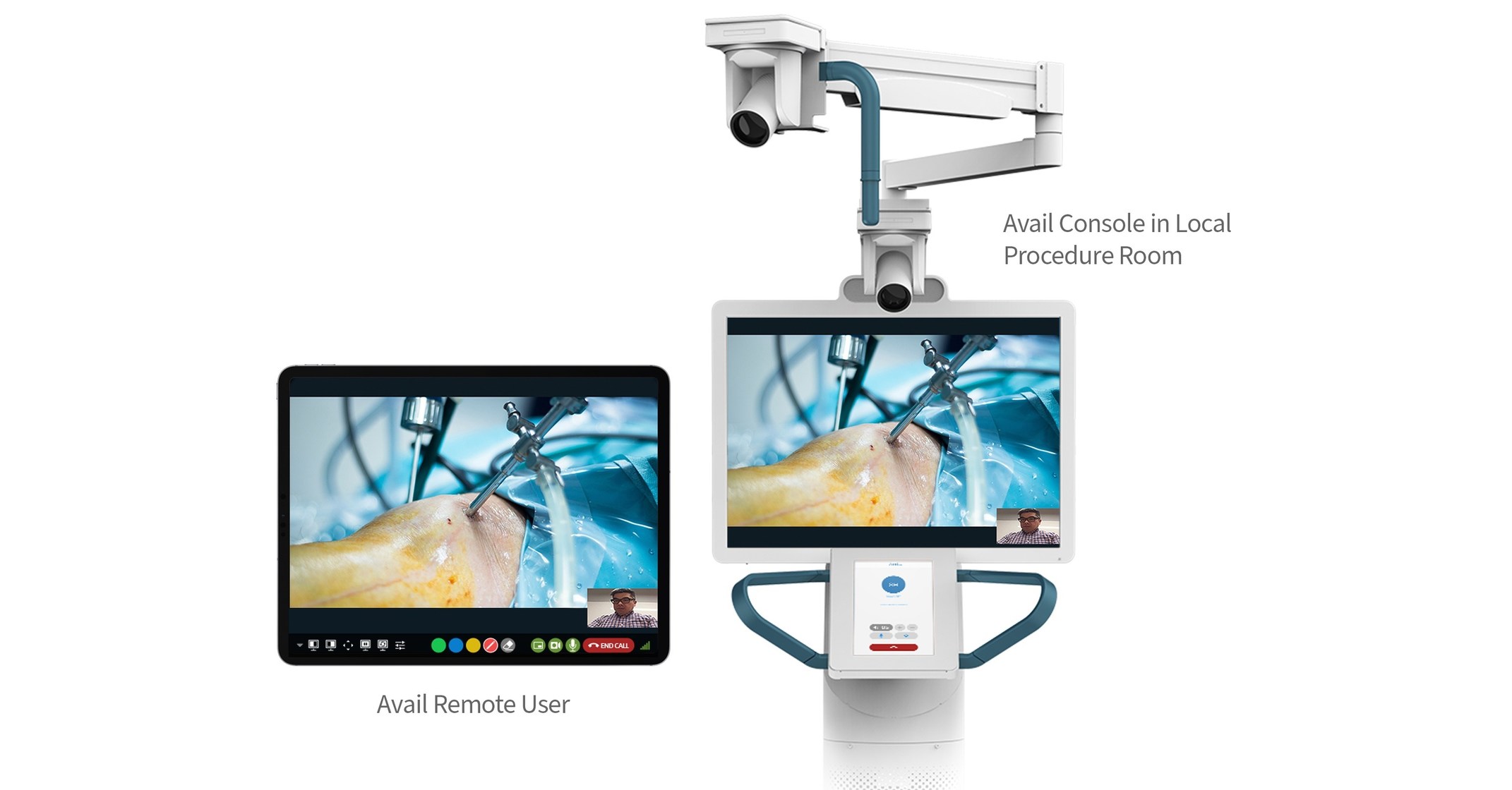Avail console in a procedure room connected to a remote user on a tablet