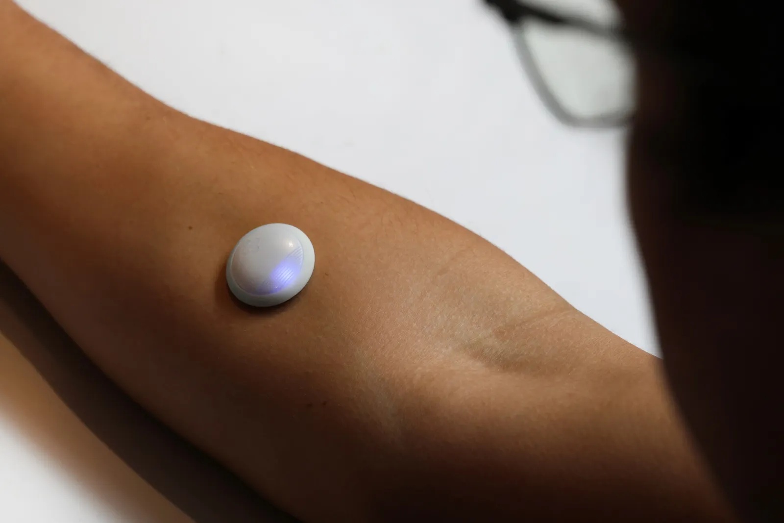 Biolinq’s round white glucose sensor worn on the inner forearm