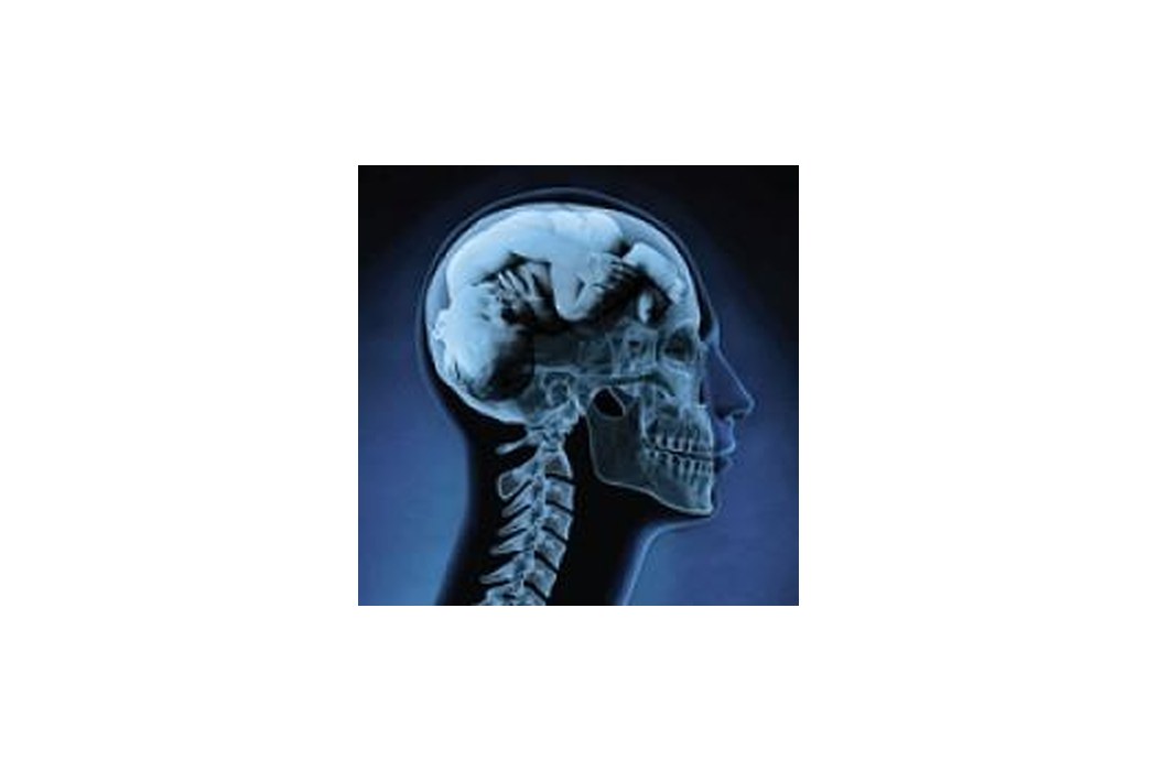 Brainchild Creative