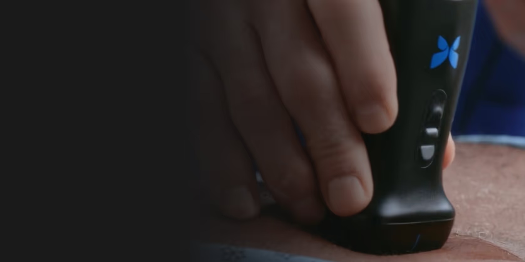 Close-up of a Butterfly handheld ultrasound probe being used against a patient’s skin