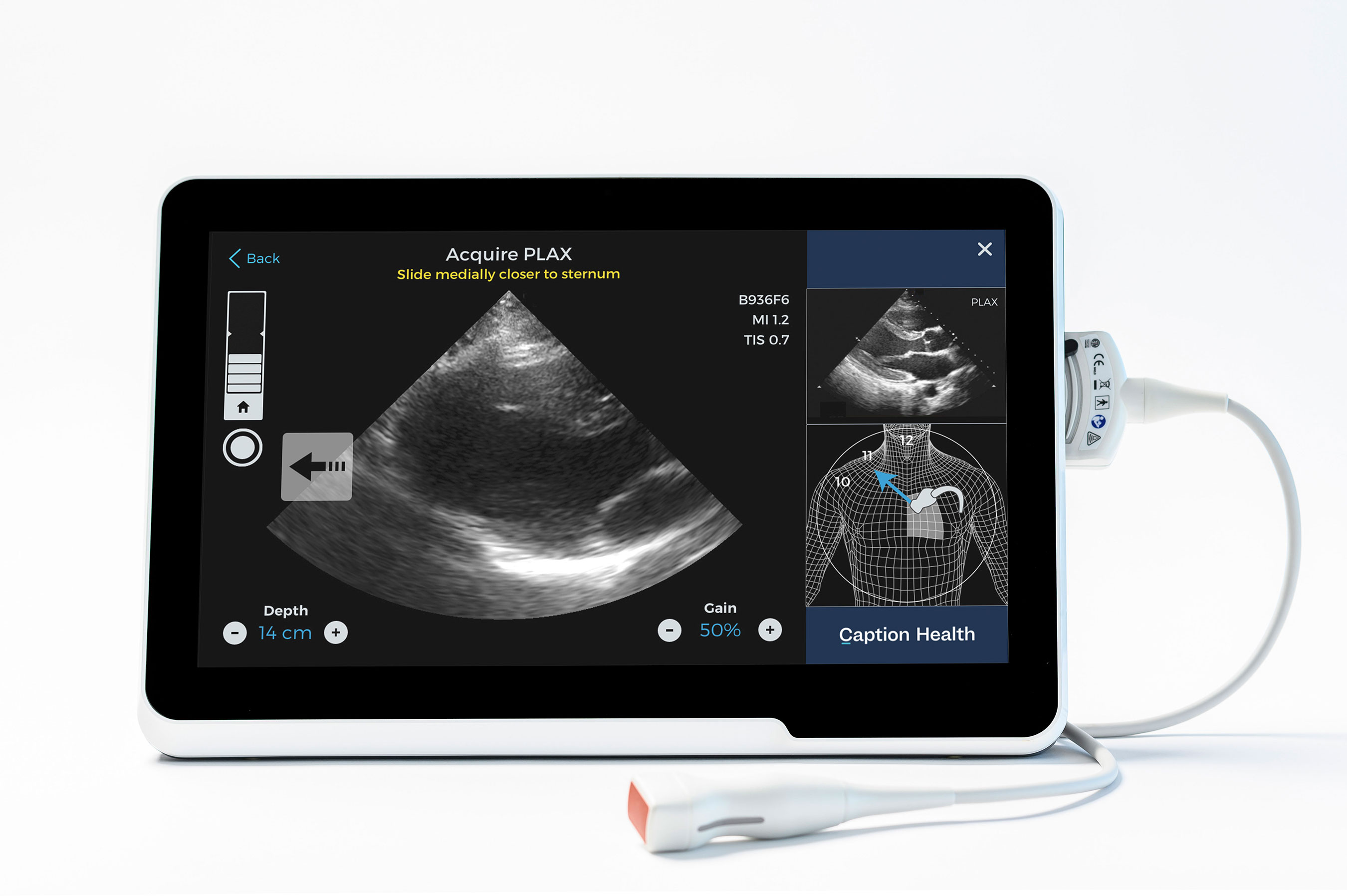 Caption Guidance interface showing a cardiac ultrasound image, probe-placement diagram and real-time instruction to slide the probe toward the sternum