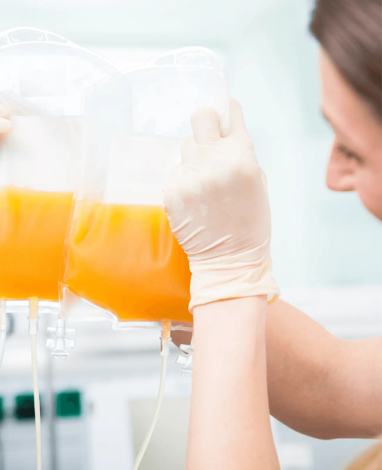 A gloved clinical specialist handling two plasma collection bags during therapeutic plasma exchange