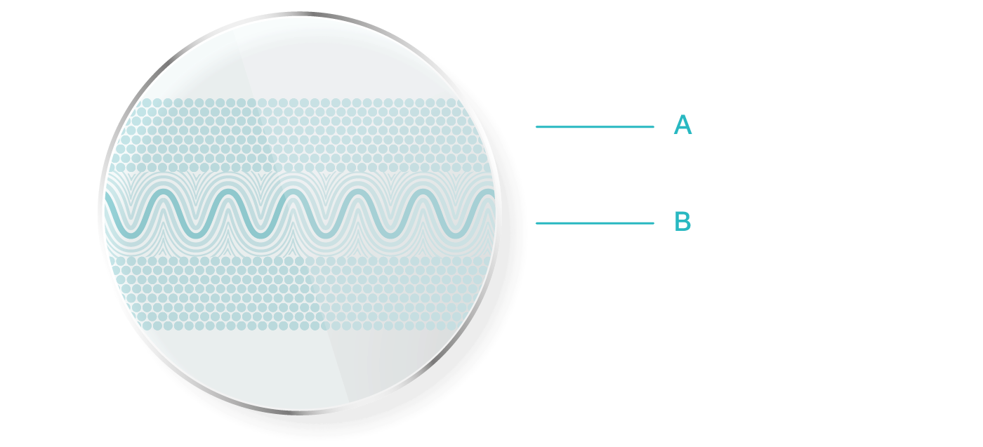 ClearCorrect diagram illustrating outer polymer layers around an elastomeric inner layer