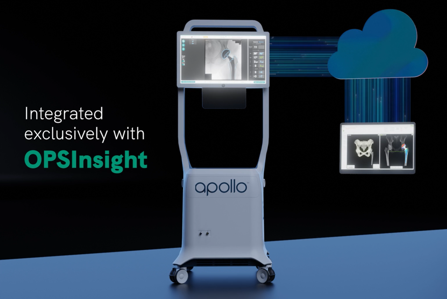 Corin illustration showing the integration of OPSInsight hip planning and ApolloHipX