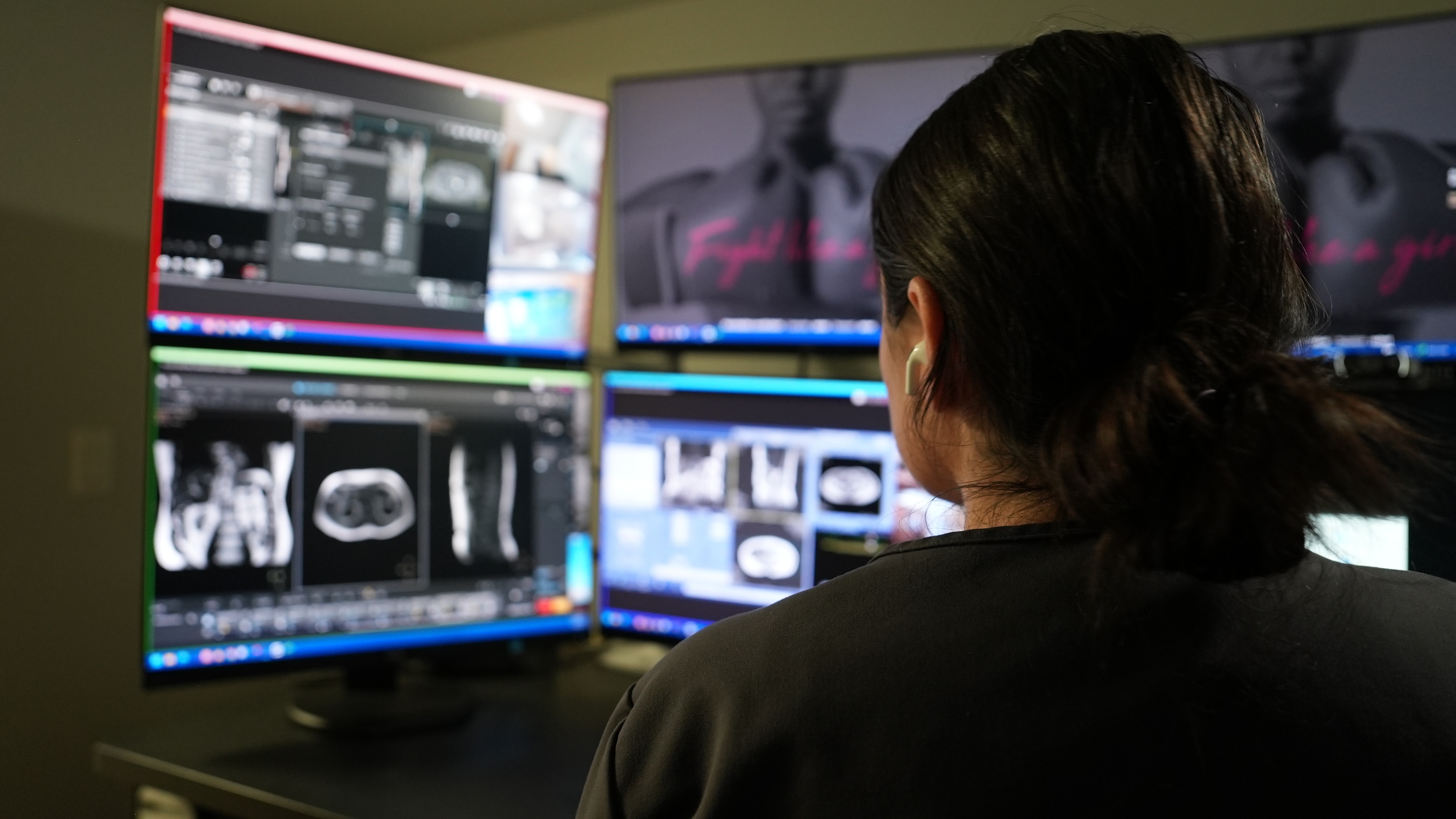 A technologist at a multi-screen TechLive remote imaging workstation