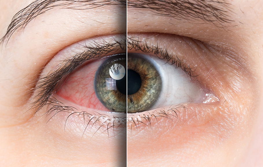 Close-up of a human eye