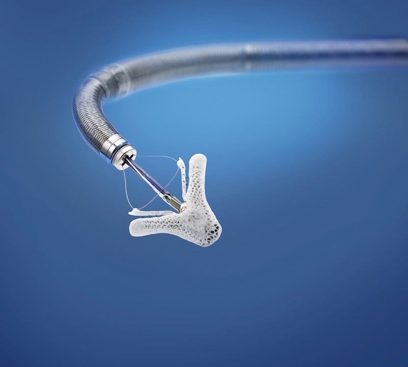 A MitraClip implant extended from a catheter against a blue background