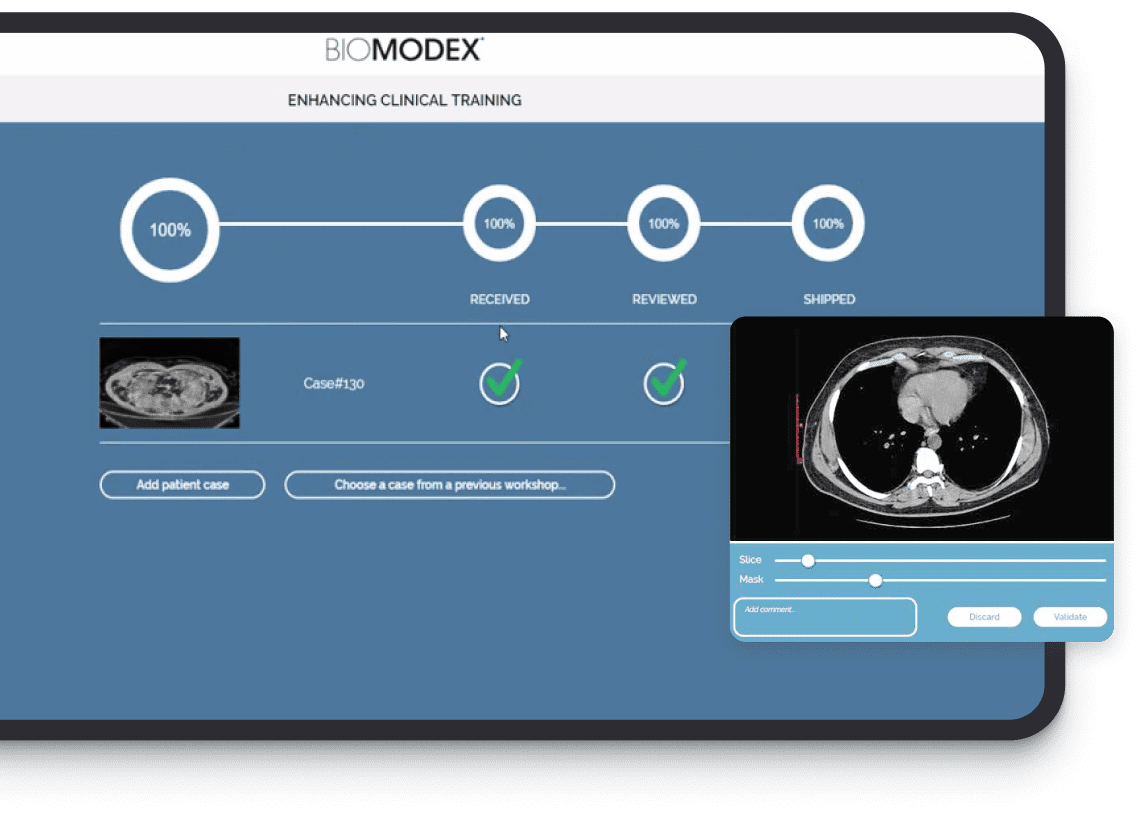 BIOMODEX interface illustration showing patient case status and a medical image viewer