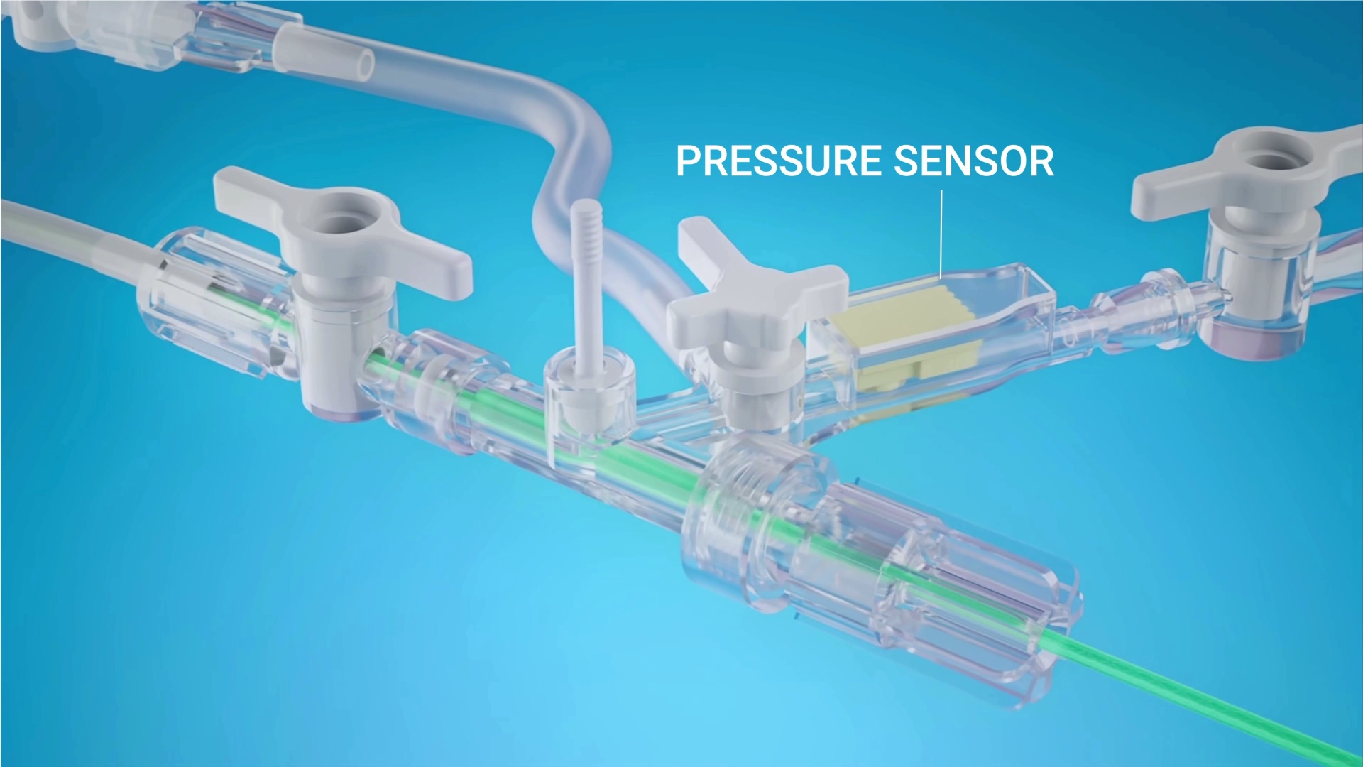Transparent 3D visualization of the EndoSphinx medical device with a labeled pressure sensor