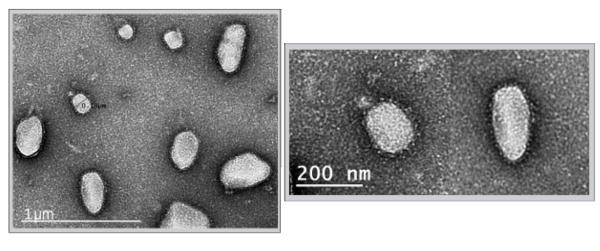 Electron microscopy images of SARS-CoV-2 virus-like particles produced in a TechnoVax and CUNY collaboration