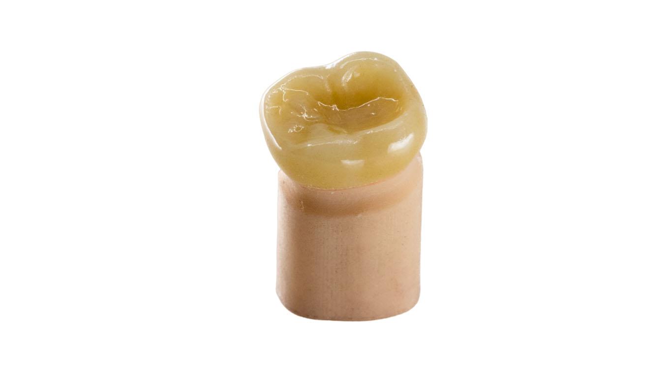 Full-contour zirconia crown on a single digital die from Leixir’s gallery