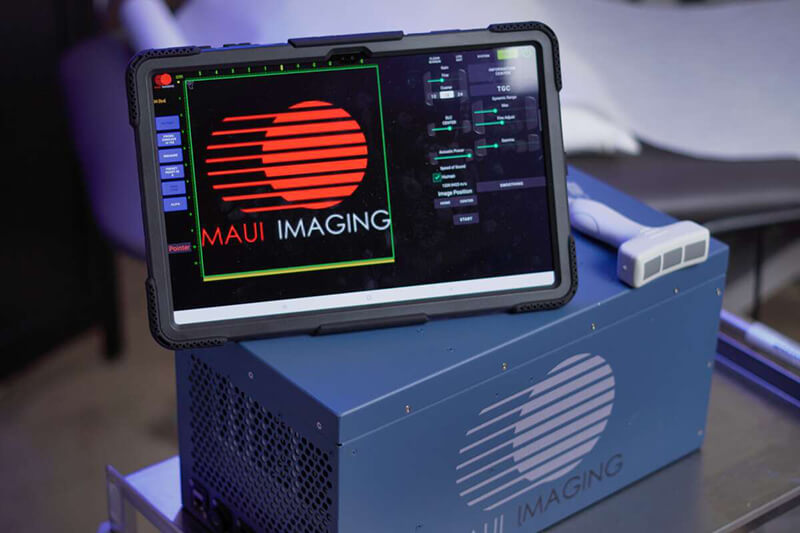 MAUI Imaging K3900 processing unit, tablet display and ultrasound probe