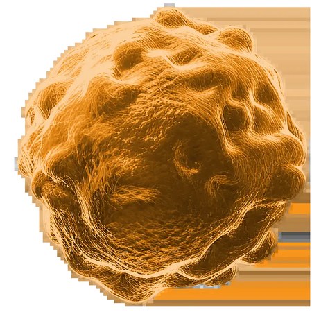 MBrace Therapeutics