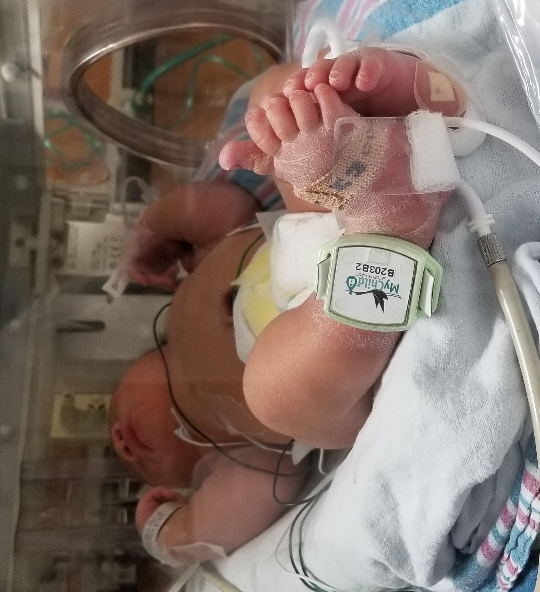 An infant wearing a MyChild security tag on the ankle
