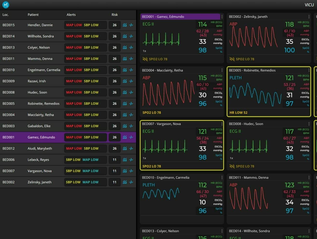 Sickbay virtual ICU interface showing multiple patient waveforms, vital signs and risk indicators