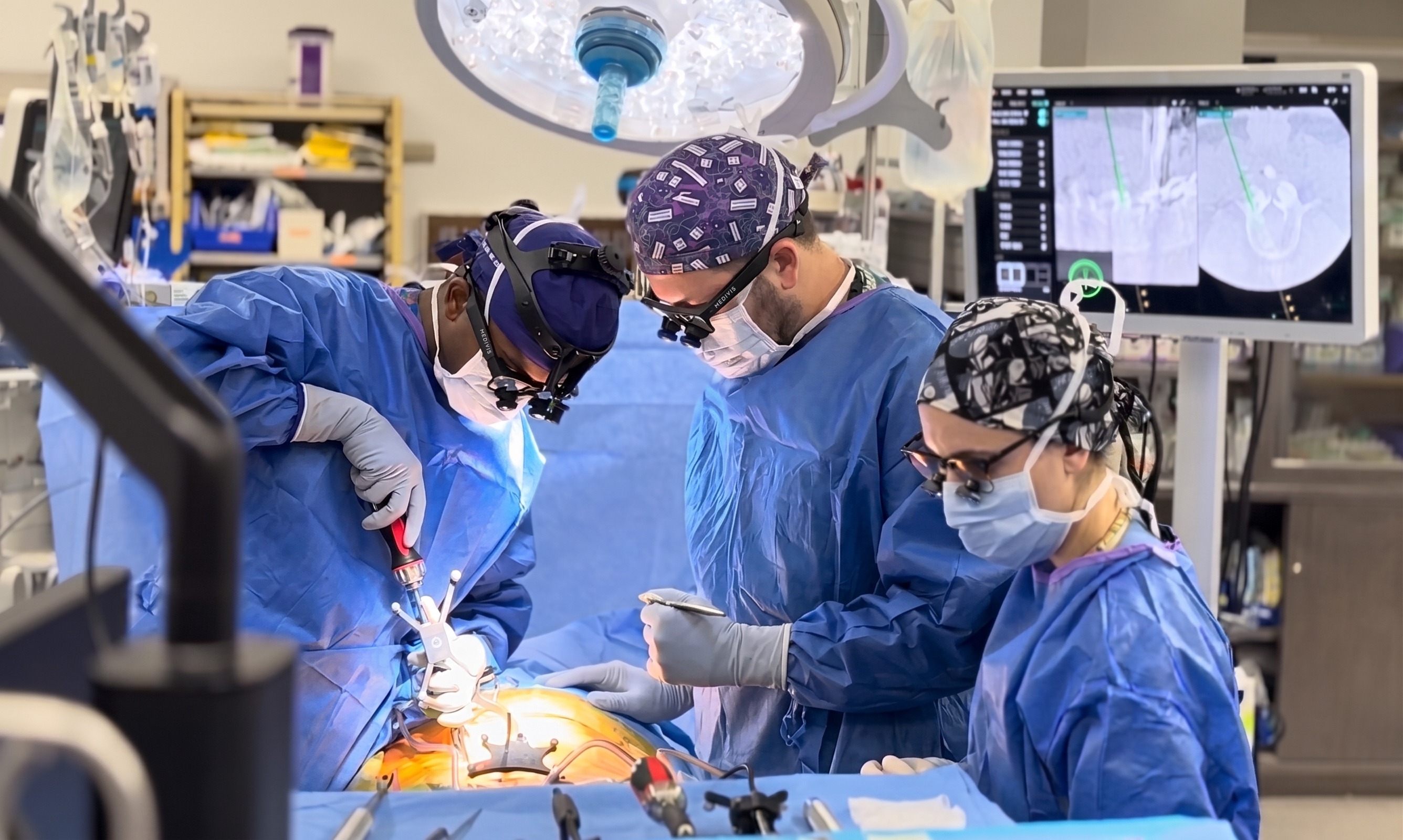 Surgical team wearing Medivis smart glasses and loupes in an operating room