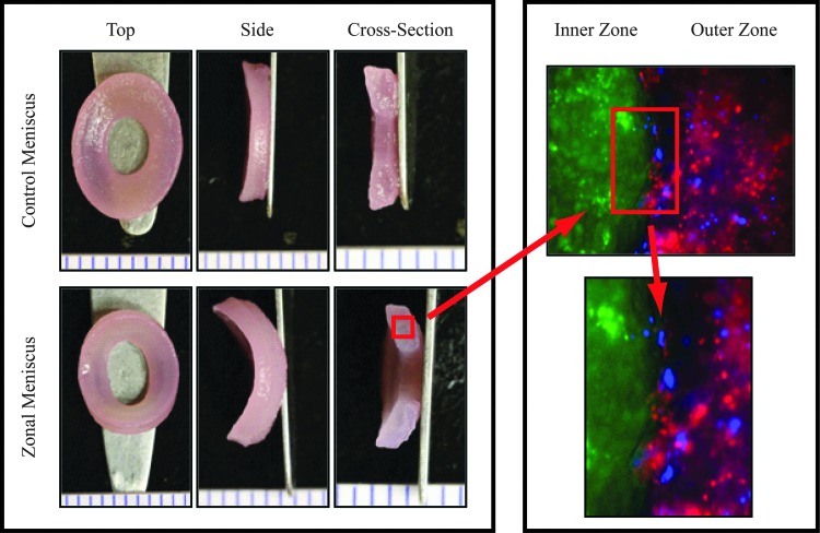 Laboratory images of control and zonal engineered meniscus constructs from Higashioka and colleagues' study