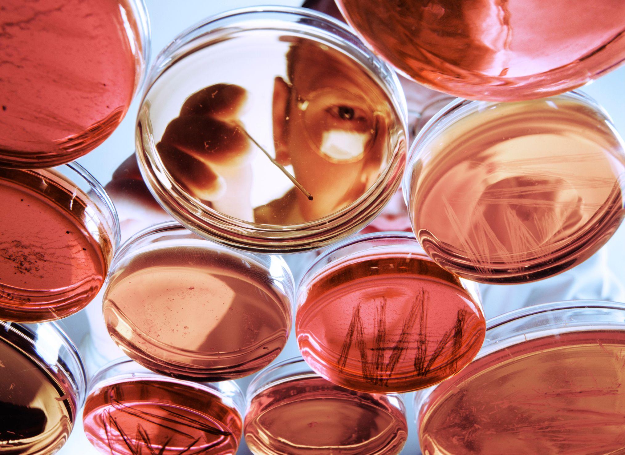 Laboratory dishes photographed through a warm red-orange arrangement