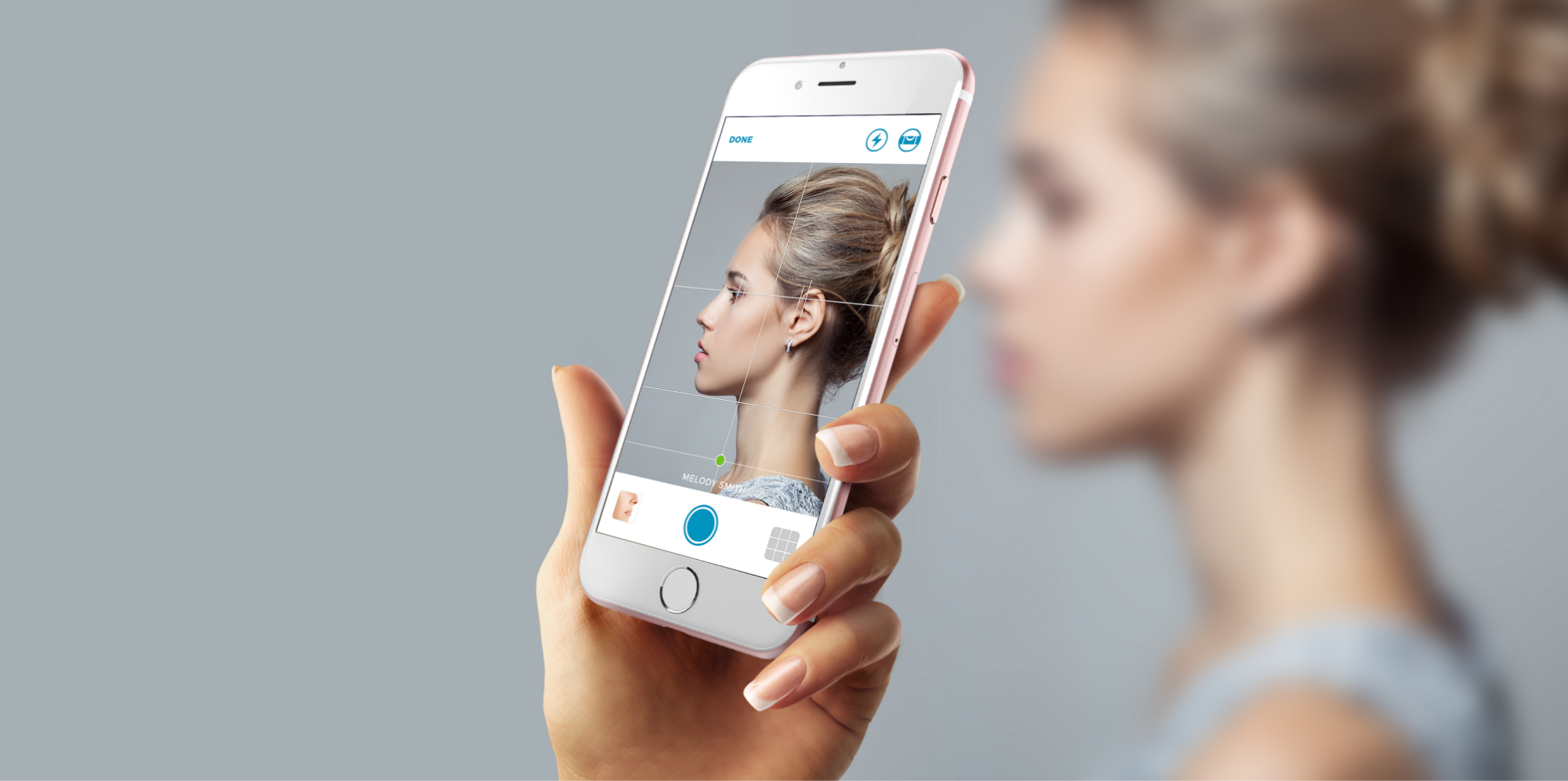 TouchMD promotional image showing a phone with positioning guides for clinical photography