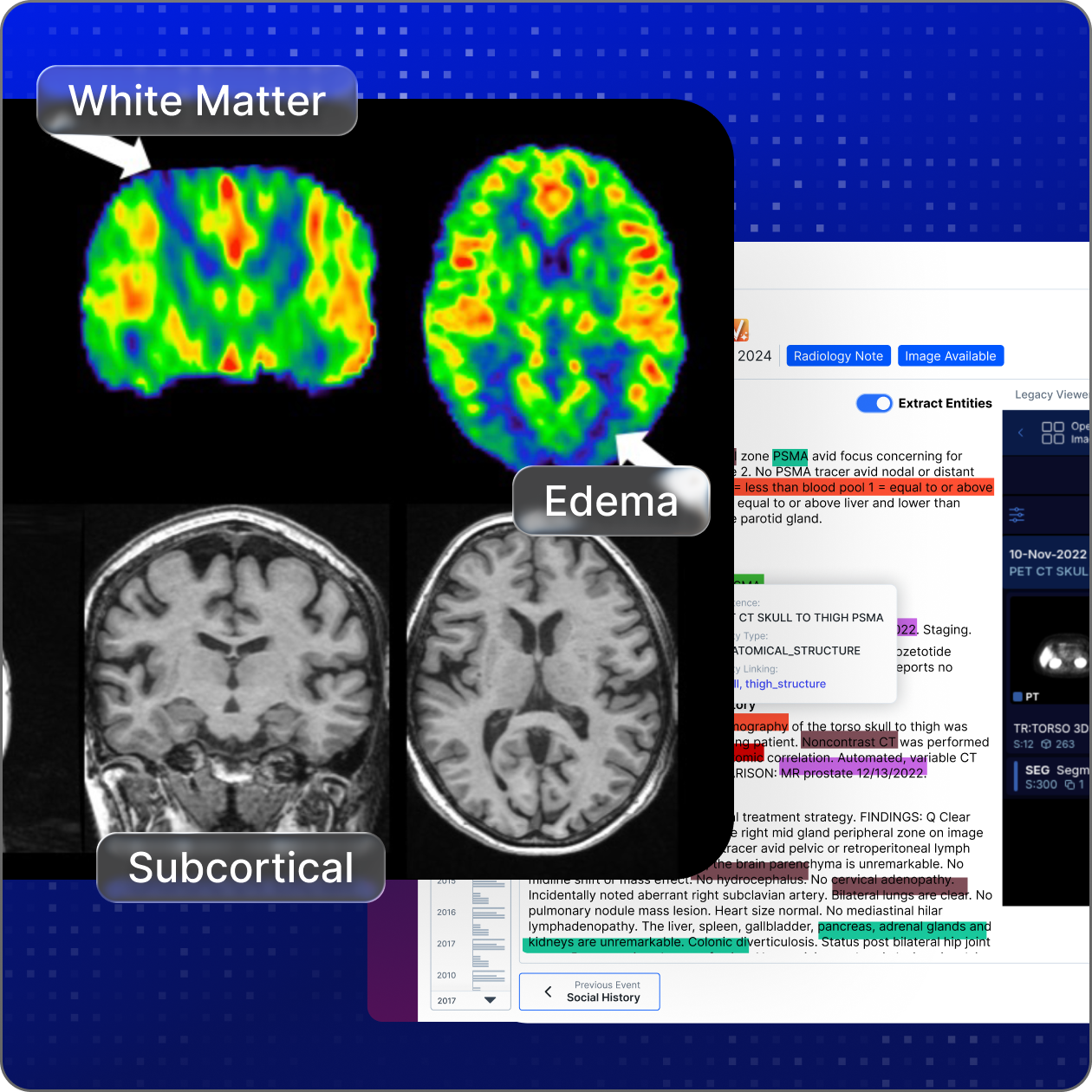 nSights promotional product image combining medical scans with annotated clinical notes