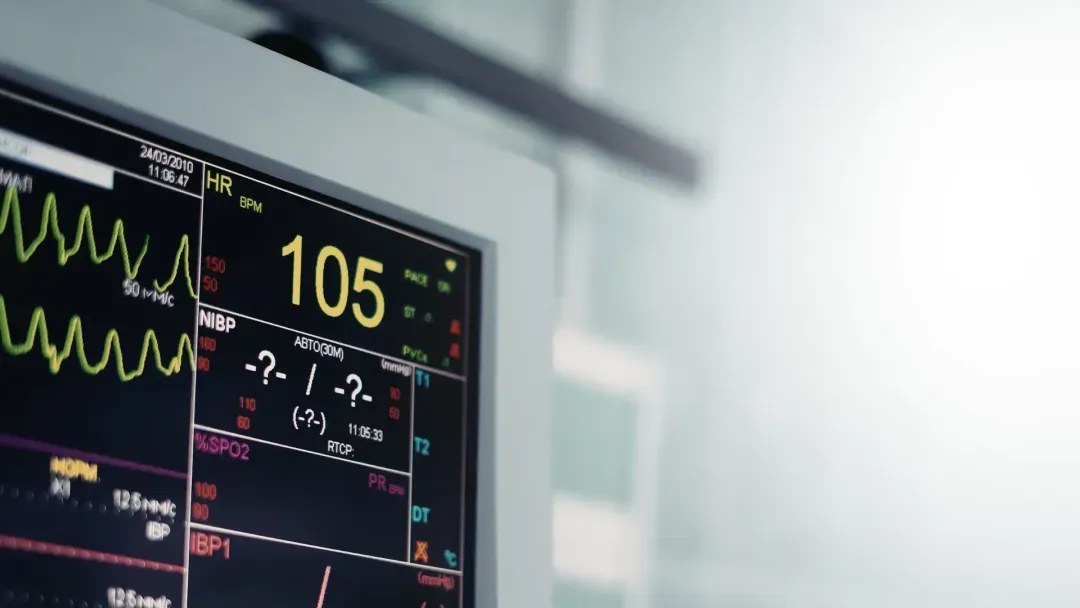 Patient vital-signs monitor showing waveforms and heart rate during surgery