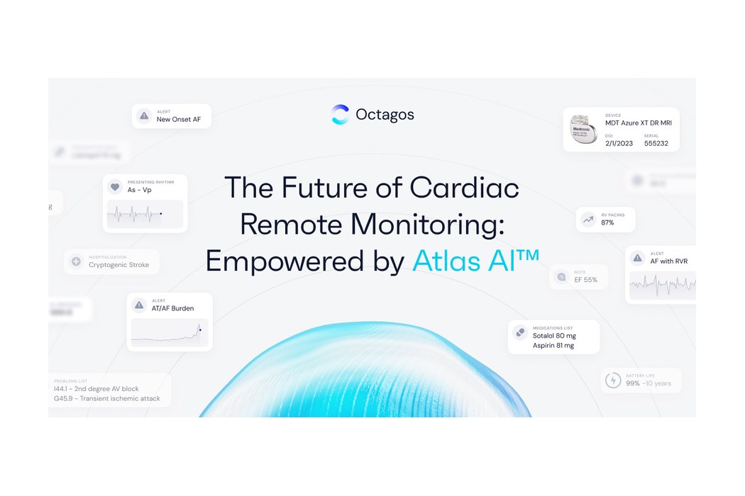 Octagos Built a Bouncer for the Cardiac Data Flood