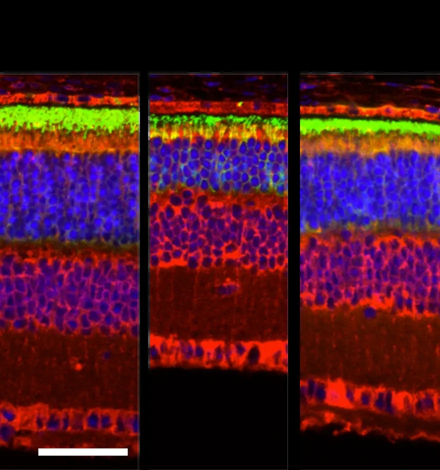 Octant's comparison of retinal structure in preclinical studies