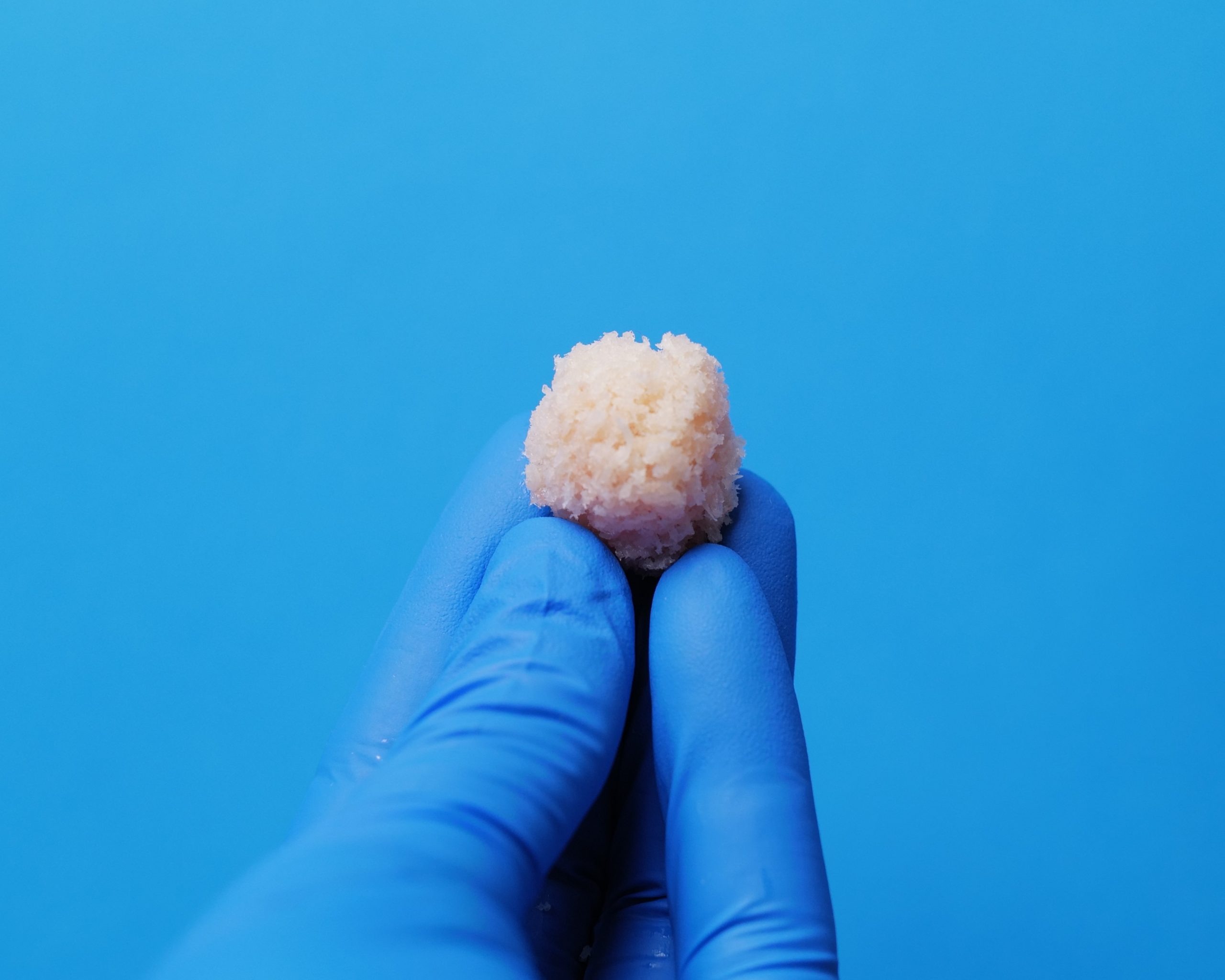 OssiGraft viable bone matrix product presentation