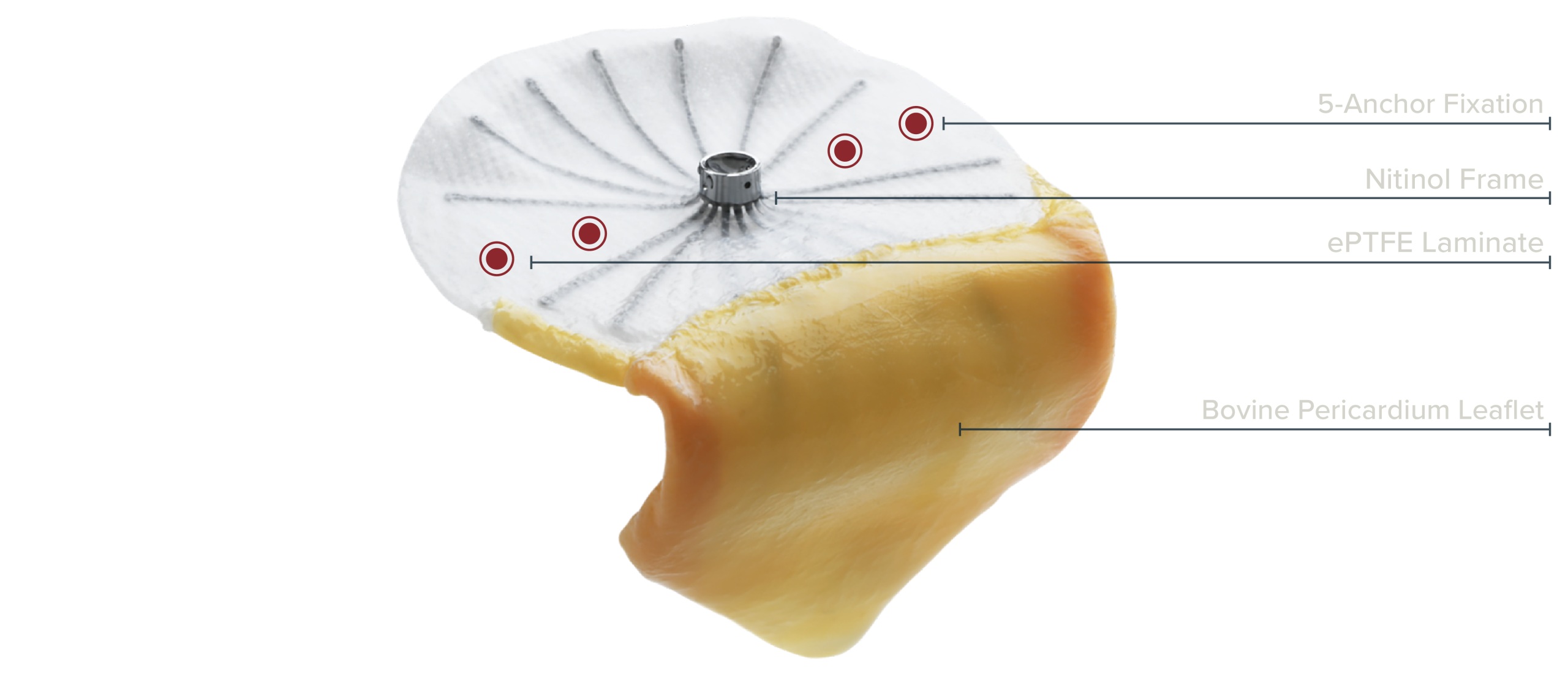 The MRace implant and catheter delivery system on a white background
