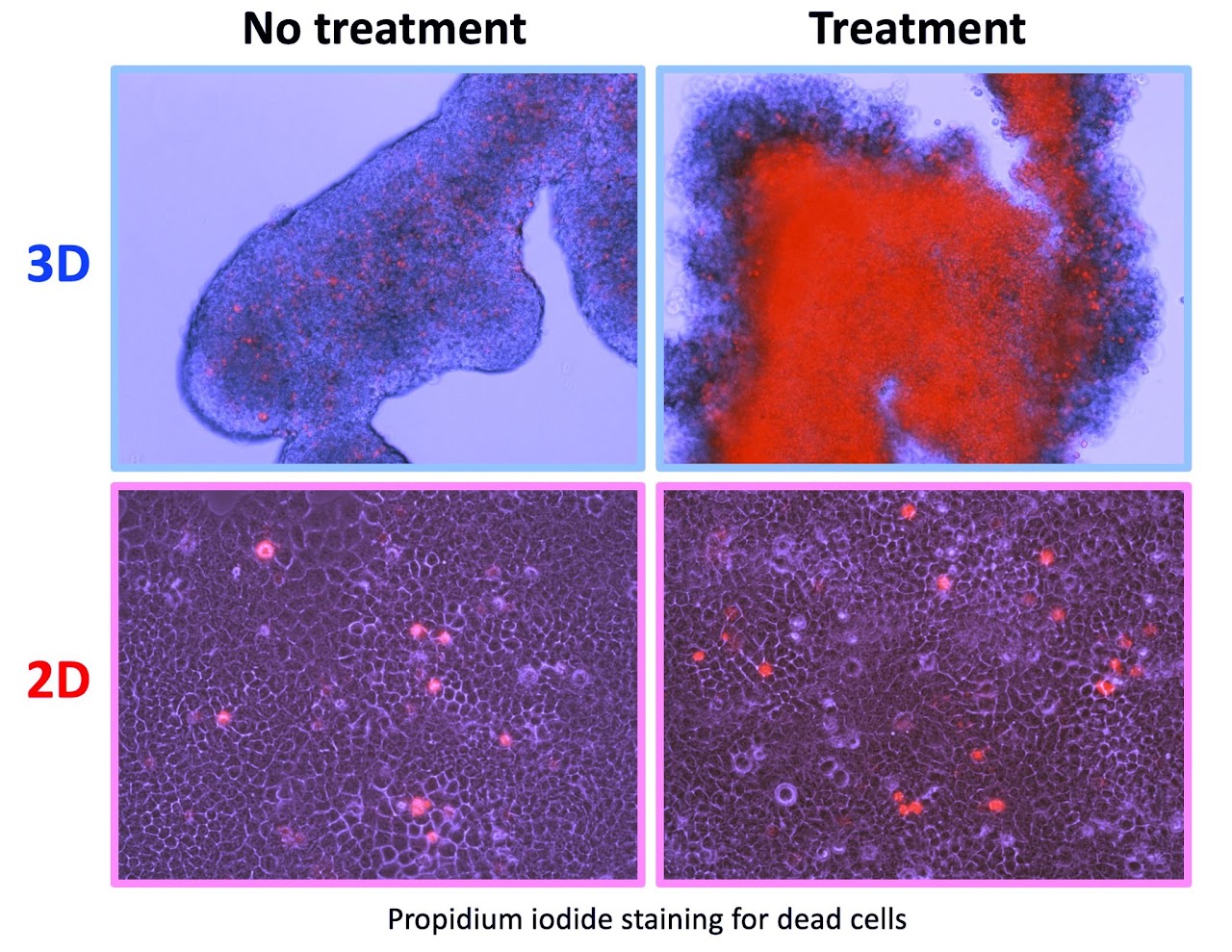 Microscopy comparison of untreated and treated cancer cells grown as 3D spheroids and 2D monolayers
