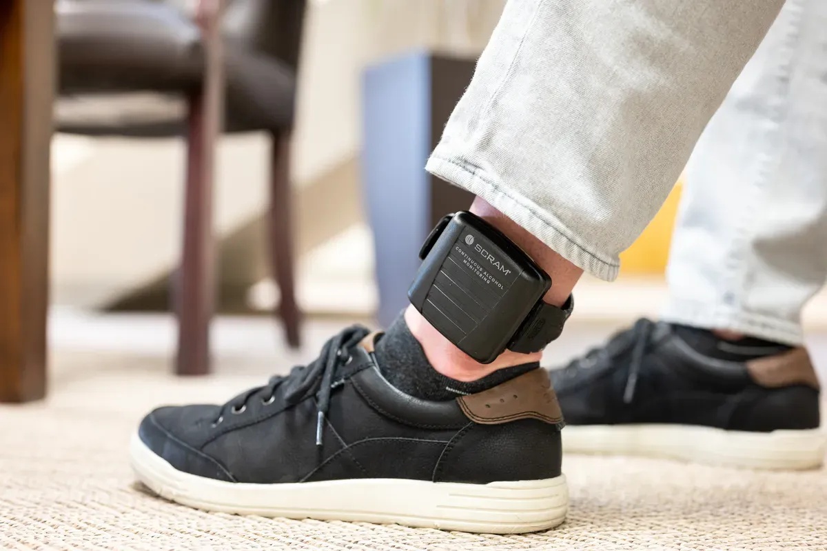 A SCRAM CAM alcohol monitor worn around an ankle in an office setting