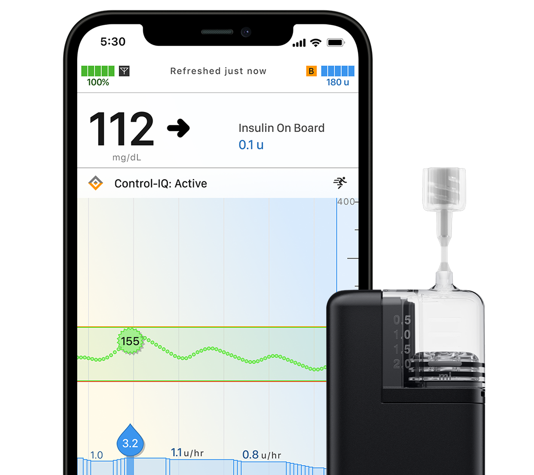 Tandem Mobi pump beside its smartphone control application