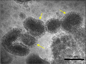 Electron micrograph of influenza virus-like particles with arrows pointing to surface glycoproteins
