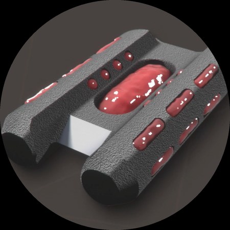 Tenon Medical, Inc.