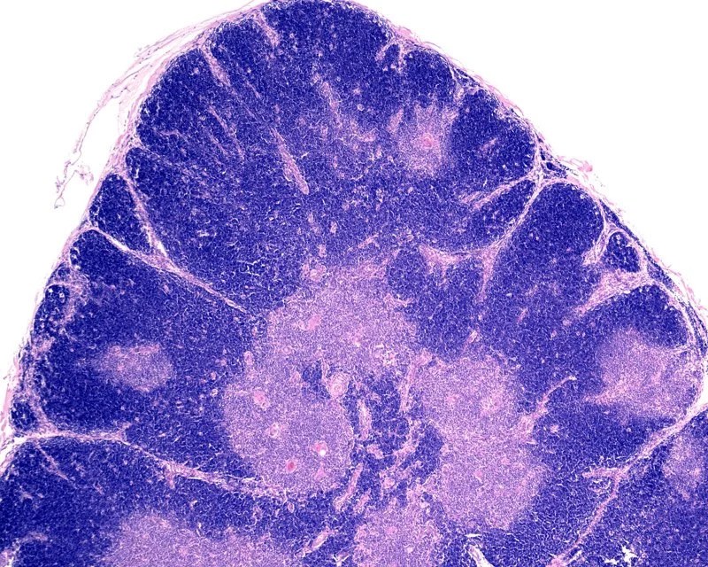 Cross-section microscopy of thymic tissue