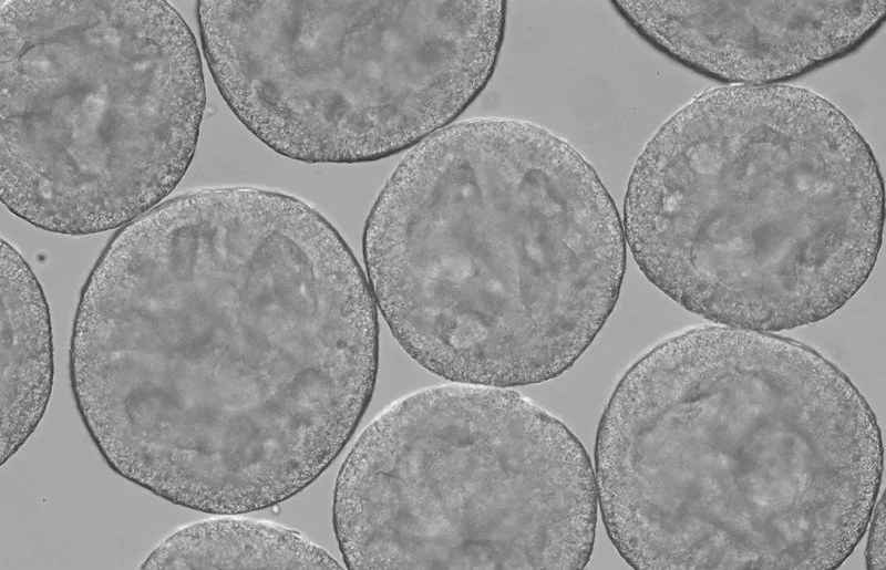 Cell spheroids under microscope
