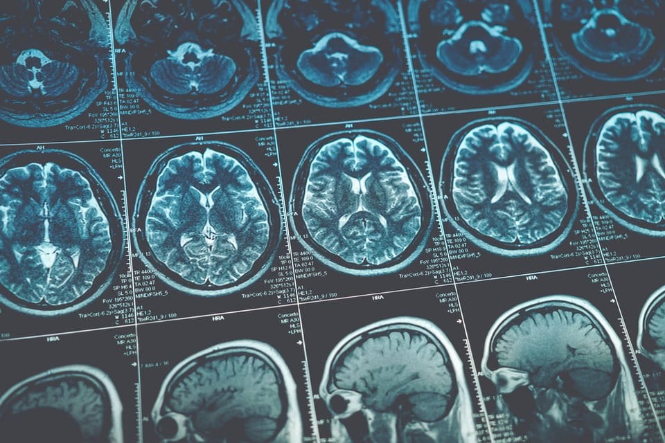 A grid of brain scan images used to illustrate the imaging problem